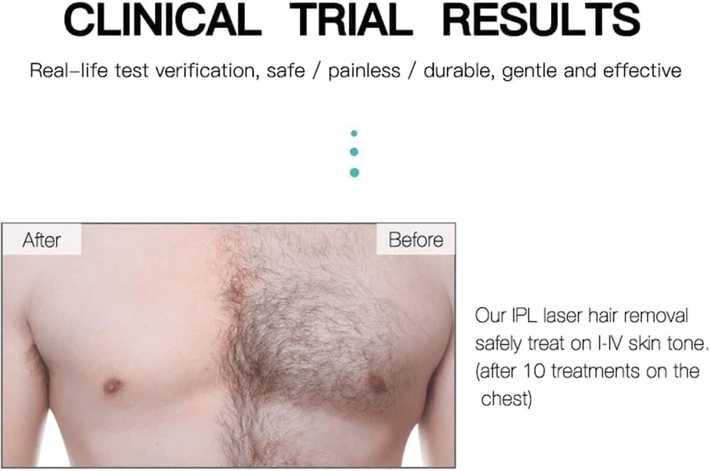 IPL Hair Removal Handset | At-Home Hair Removal Device for Men & Women | Multiple Intensity Levels | Corded IPL Epilator for Body Use